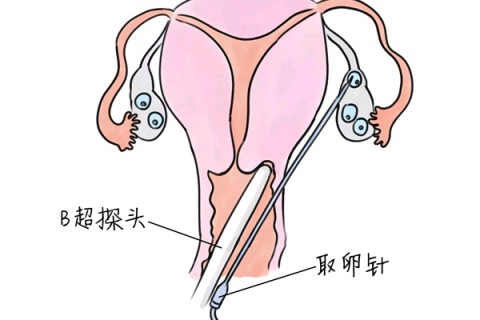 http://jiaxing.vdtfzz.com/post/205.html|嘉兴供卵助孕